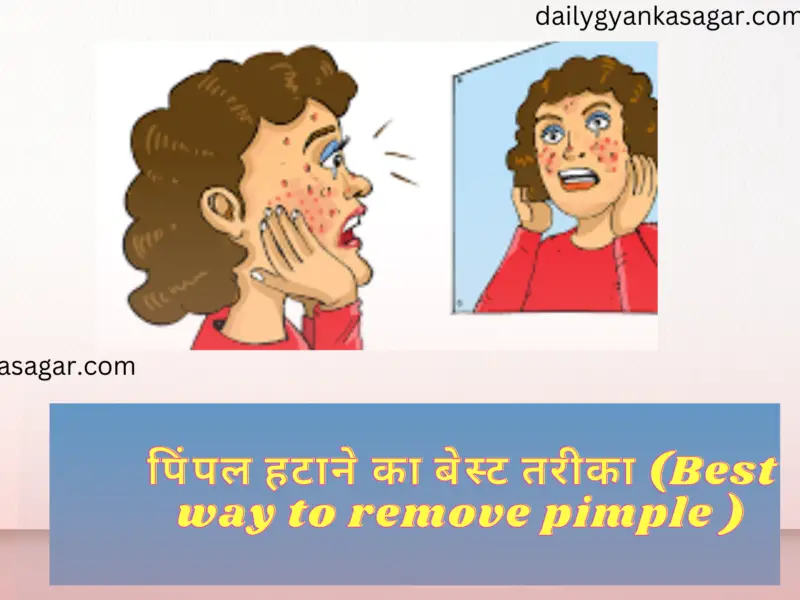 पिंपल हटाने का बेस्ट तरीका (Best way to remove pimple )